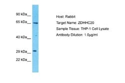 ZDHHC20 Rabbit anti-Human, Polyclonal, Novus Biologicals 0.1 mL | Buy Online | Novus Biologicals | Fisher Scientific